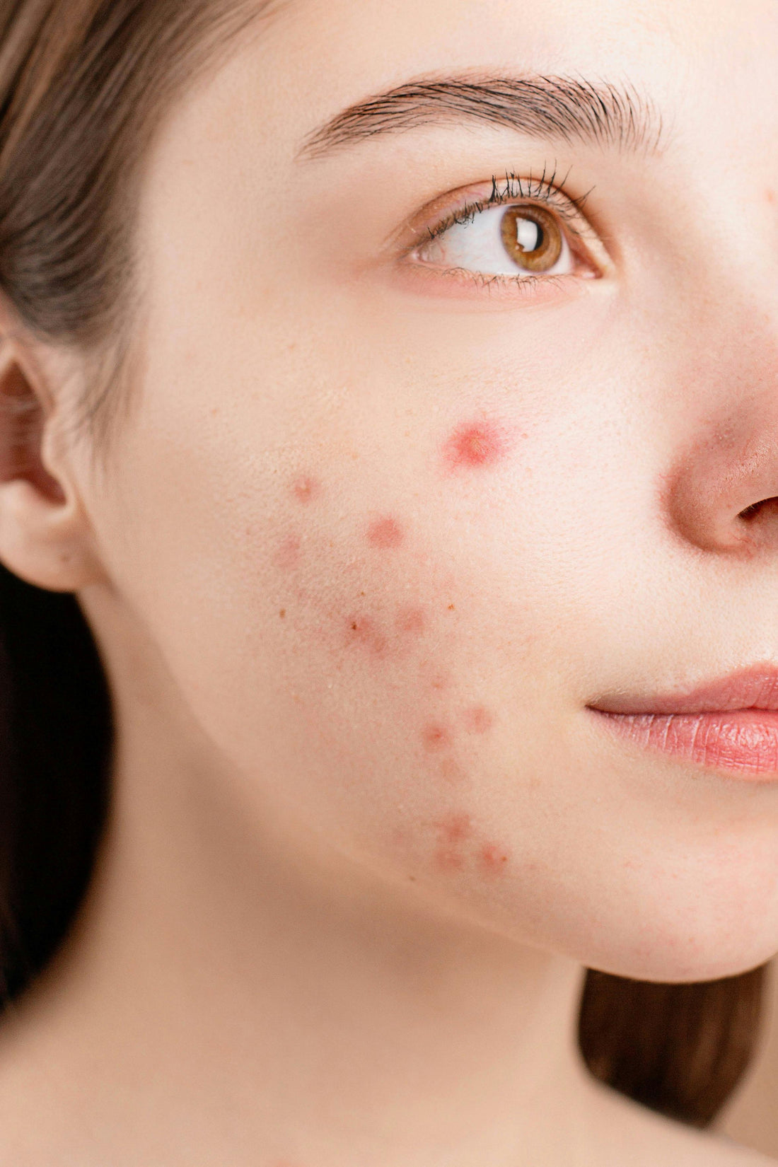 "Ozempic Face" & Weight Loss Skin Care: Preventing and Treating Skin Changes